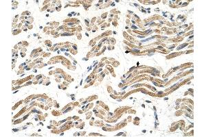 ALDH4A1 antibody was used for immunohistochemistry at a concentration of 4-8 ug/ml to stain Skeletal muscle cells (arrows) in Human Muscle.