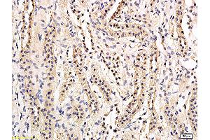Formalin-fixed and paraffin embedded rat kidney labeled with Anti-phospho-AQP2(Ser269) Polyclonal Antibody, Unconjugated (ABIN756127) followed by conjugation to the secondary antibody and DAB staining (AQP2 anticorps  (pSer269))