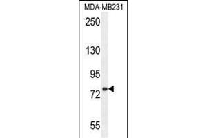 SORBS1 Antibody (Center) (ABIN654646 and ABIN2844342) western blot analysis in MDA-M cell line lysates (35 μg/lane). (SORBS1 anticorps  (AA 866-892))