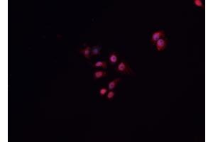 ABIN6268941 staining A549 cells by IF/ICC. (HNF1B anticorps  (Internal Region))