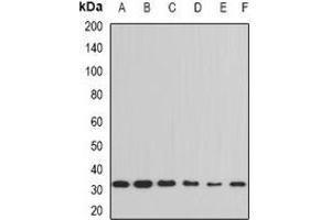Western blot analysis of Cyclophilin E expression in Hela (A), THP1 (B), Jurkat (C), HL60 (D), mouse testis (E), mouse thymus (F) whole cell lysates.