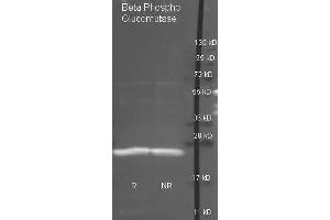 Goat anti antibody ( was used to detect purified Beta Phospho Glucomutase under reducing (R) and non-reducing (NR) conditions. (Beta-Phosphoglucomutase anticorps  (HRP))