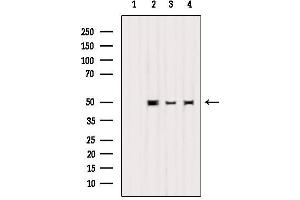 Western blot analysis of extracts from various samples, using K1H2 Antibody. (KRT32 anticorps  (Internal Region))