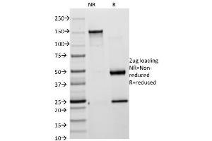 SDS-PAGE Analysis of Purified Cytokeratin 18 Mouse Monoclonal Antibody (KRT18/835). (KRT8, KRT18 anticorps)