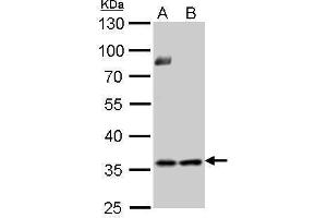 WB Image Thymidylate synthetase antibody detects TYMS protein by Western blot analysis. (TYMS anticorps)