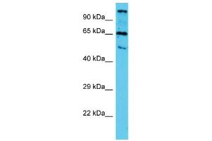 Western Blotting (WB) image for anti-Tubulin tyrosine Ligase-Like Family, Member 10 (TTLL10) (N-Term) antibody (ABIN2790879) (TTLL10 anticorps  (N-Term))