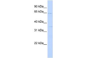 WB Suggested Anti-RORA Antibody Titration:  0. (RORA anticorps  (N-Term))