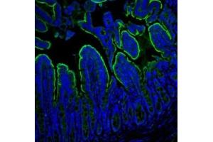 IF analysis of Villin using anti-Villin antibody (ABIN3042343). (Villin 1 anticorps  (C-Term))