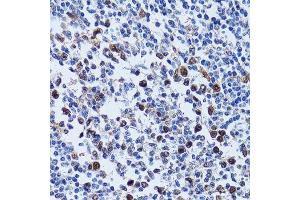 Immunohistochemistry of paraffin-embedded human tonsil using UHRF1 antibody.