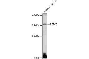 Western blot analysis of extracts of Mouse thymus, using RBM7 antibody (ABIN7270088) at 1:1000 dilution.