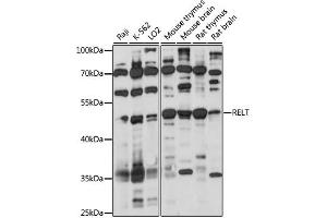 anti-RELT Tumor Necrosis Factor Receptor (RELT) (AA 26-162) antibody