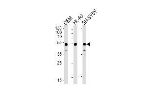 Western blot analysis of lysates from CEM, HL-60, SH-SY5Y cell lines (from left to right) using GATA3 Antibody (Center) (ABIN1944795 and ABIN2838499). (GATA3 anticorps  (AA 1-444))