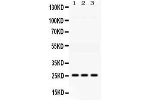 Western blot analysis of AK2 expression in rat liver extract ( Lane 1), mouse kidney extract ( Lane 2) and HELA whole cell lysates ( Lane 3). (Adenylate Kinase 2 anticorps  (AA 161-239))