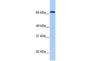 Calicin antibody used at 1 ug/ml to detect target protein. (Calicin anticorps  (C-Term))