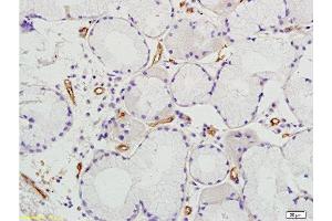 Formalin-fixed and paraffin embedded human colon tissue labeled with Anti Prominin2 Polyclonal Antibody, Unconjugated  at 1:200 followed by conjugation to the secondary antibody and DAB staining (Prominin 2 anticorps  (AA 301-400))