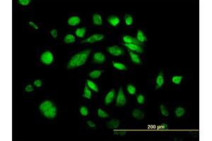 Immunofluorescence of monoclonal antibody to POLK on HeLa cell.