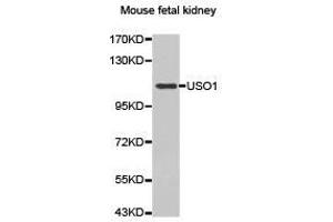 Western Blotting (WB) image for anti-USO1 Homolog, Vesicle Docking Protein (USO1) antibody (ABIN1875291) (USO1 anticorps)