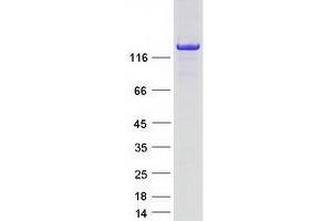 Validation with Western Blot
