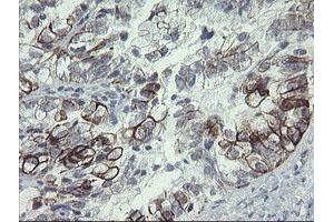 Image no. 13 for anti-Src-like-adaptor 2 (SLA2) antibody (ABIN1500949) (SLAP2 anticorps)