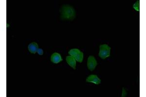 Immunofluorescence staining of MCF-7 cells with ABIN7139704 at 1:50, counter-stained with DAPI. (PSMD6 anticorps  (Regulatory Subunit 6))