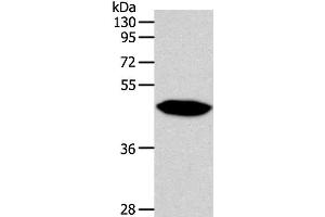 Western Blot analysis of Human fetal brain tissue using NPY1R Polyclonal Antibody at dilution of 1:500 (NPY1R anticorps)