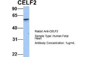 Host: Rabbit Target Name: CELF2 Sample Type: Human Fetal Heart Antibody Dilution: 1. (CELF2 anticorps  (N-Term))