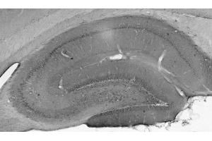 Adult rat hippocampus immunohistochemistry.