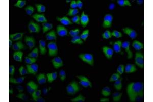 Immunofluorescence staining of Hela cells with ABIN7152666 at 1:133, counter-stained with DAPI. (FCRL5 anticorps  (AA 419-553))
