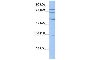 TSKS antibody used at 1 ug/ml to detect target protein. (TSKS anticorps  (N-Term))