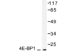 Image no. 2 for anti-Eukaryotic Translation Initiation Factor 4E Binding Protein 1 (EIF4EBP1) antibody (ABIN271863) (eIF4EBP1 anticorps)
