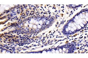 Detection of CASP8 in Porcine Colon Tissue using Polyclonal Antibody to Caspase 8 (CASP8)