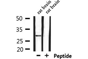 Western blot analysis of extracts from rat brain, using OR6C75 Antibody.