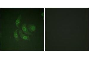 Immunofluorescence analysis of HepG2 cells, using CaMK4 (Ab-196/200) Antibody. (CAMK4 anticorps  (AA 166-215))