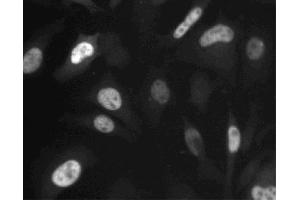 Immunofluorescent staining of HeLa (ATCC CCL-2) cells. (Cyclin A anticorps  (AA 26-144))