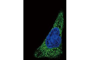 Confocal immunofluorescent analysis of SLC11A2 Antibody with HepG2 cell followed by Alexa Fluor 488-conjugated goat anti-rabbit lgG (green). (SLC11A2 anticorps  (AA 262-291))