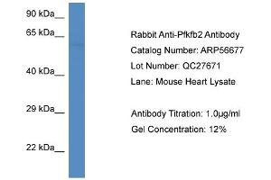 Western Blotting (WB) image for anti-6-phosphofructo-2-Kinase/fructose-2,6-Biphosphatase 2 (PFKFB2) (C-Term) antibody (ABIN2786833) (PFKFB2 anticorps  (C-Term))