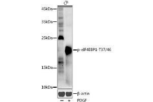 Western blot analysis of extracts of C6 cells, using Phospho-eIF4EBP1-T37/46 antibody (ABIN3019469, ABIN3019470, ABIN3019471 and ABIN6225387) at 1:1000 dilution.