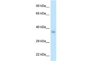 WB Suggested Anti-PITX2 Antibody Titration: 1. (PITX2 anticorps  (N-Term))