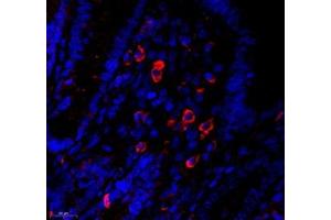 Immunofluorescence of paraffin embedded mouse appendix using MS4A2 (ABIN7074594) at dilution of 1: 400 (550x lens)