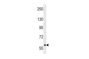 TEC Antibody  (ABIN392111 and ABIN2841862) western blot analysis in NCI- cell line lysates (35 μg/lane).