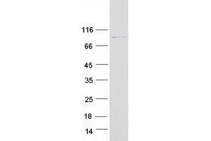 Validation with Western Blot