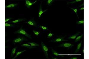 Immunofluorescence of purified MaxPab antibody to CUGBP1 on HeLa cell. (CELF1 anticorps  (AA 1-483))