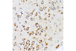 Immunohistochemistry of paraffin-embedded mouse brain using RPS20 Rabbit mAb (ABIN7270017) at dilution of 1:100 (40x lens). (RPS20 anticorps)