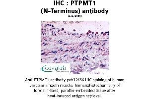Image no. 1 for anti-Protein Tyrosine Phosphatase, Mitochondrial 1 (PTPMT1) (N-Term) antibody (ABIN1738592) (PTPMT1 anticorps  (N-Term))