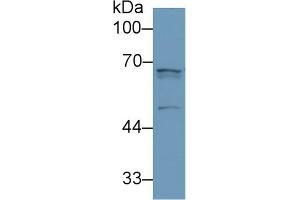 Detection of ANGPT2 in Human Lung lysate using Polyclonal Antibody to Angiopoietin 2 (ANGPT2)