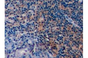 Detection of CD19 in Human Tonsil Tissue using Polyclonal Antibody to Cluster Of Differentiation 19 (CD19)