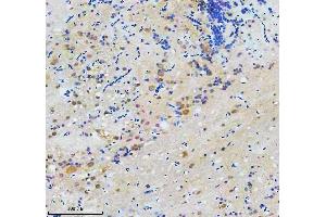 IHC analysis of CCT7 using anti-CCT7 antibody (AZQ8JHG7).