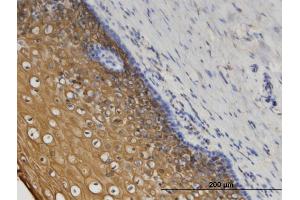 Immunoperoxidase of monoclonal antibody to CORO1C on formalin-fixed paraffin-embedded human uterine cervix.