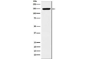 Western blot analysis of p150 CAF1 expression in K562 cell lysate.
