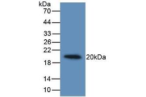 Detection of Recombinant IL19, Human using Monoclonal Antibody to Interleukin 19 (IL19)